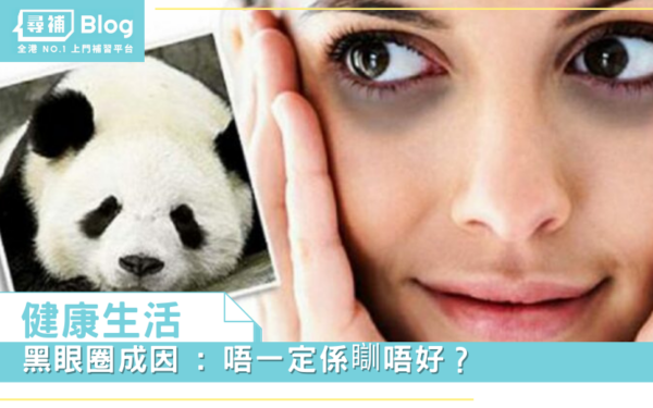 Read more about the article 【健康生活】黑眼圈成因 : 唔一定係瞓唔好？